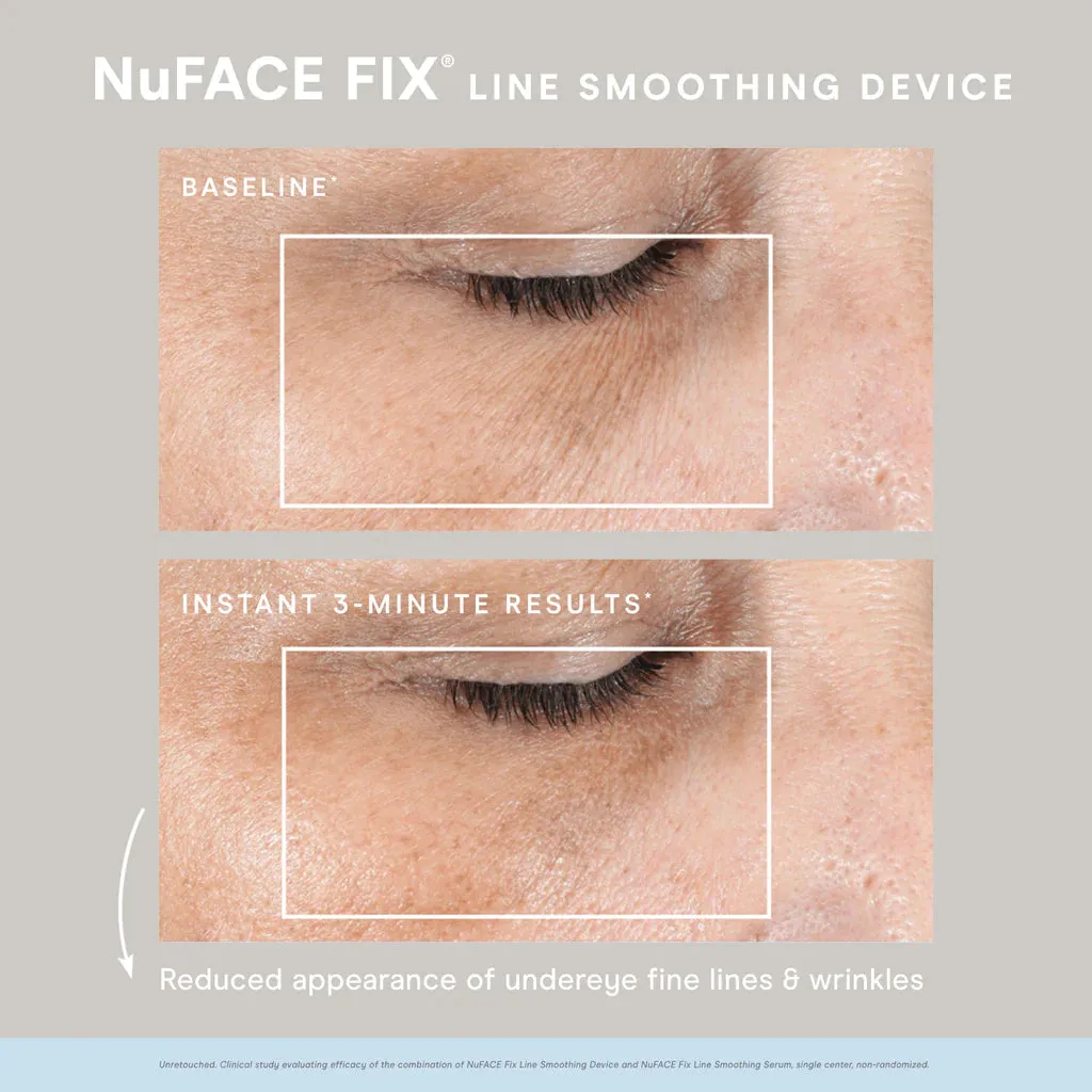 NuFACE FIX® Starter Kit